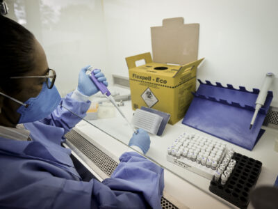 Distrito Federal registra 29 casos importados de malária em 2025