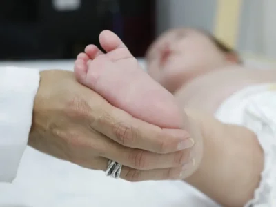 Teste do pezinho atrasado dificulta diagnóstico precoce da AME